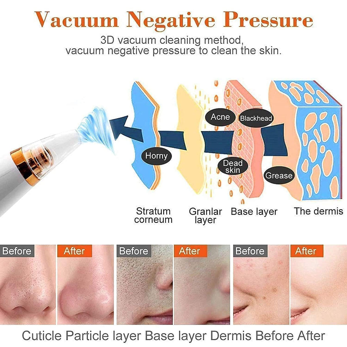 Derma Suction - Face Skin Cleaner
