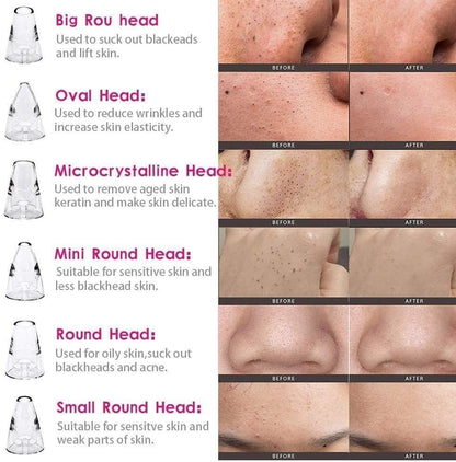 Derma Suction - Face Skin Cleaner