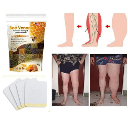 Bee Venom Foot Patches - For Weight-Loss & Stress Relief
